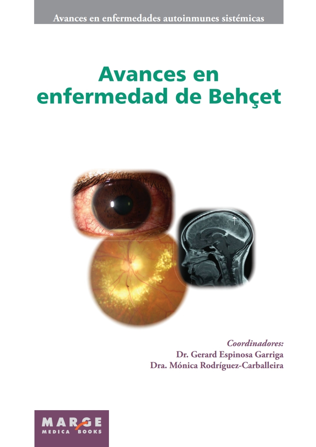 Avances en enfermedad de Behçet 1st Edition