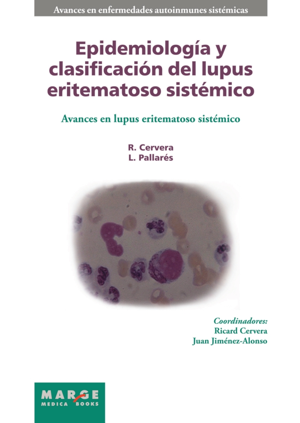 Epidemiología y clasificación del lupus eritematoso sistémico 1st Edition