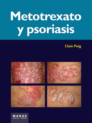 Cover image: Metotrexato y psoriasis 1st edition 9788415340409