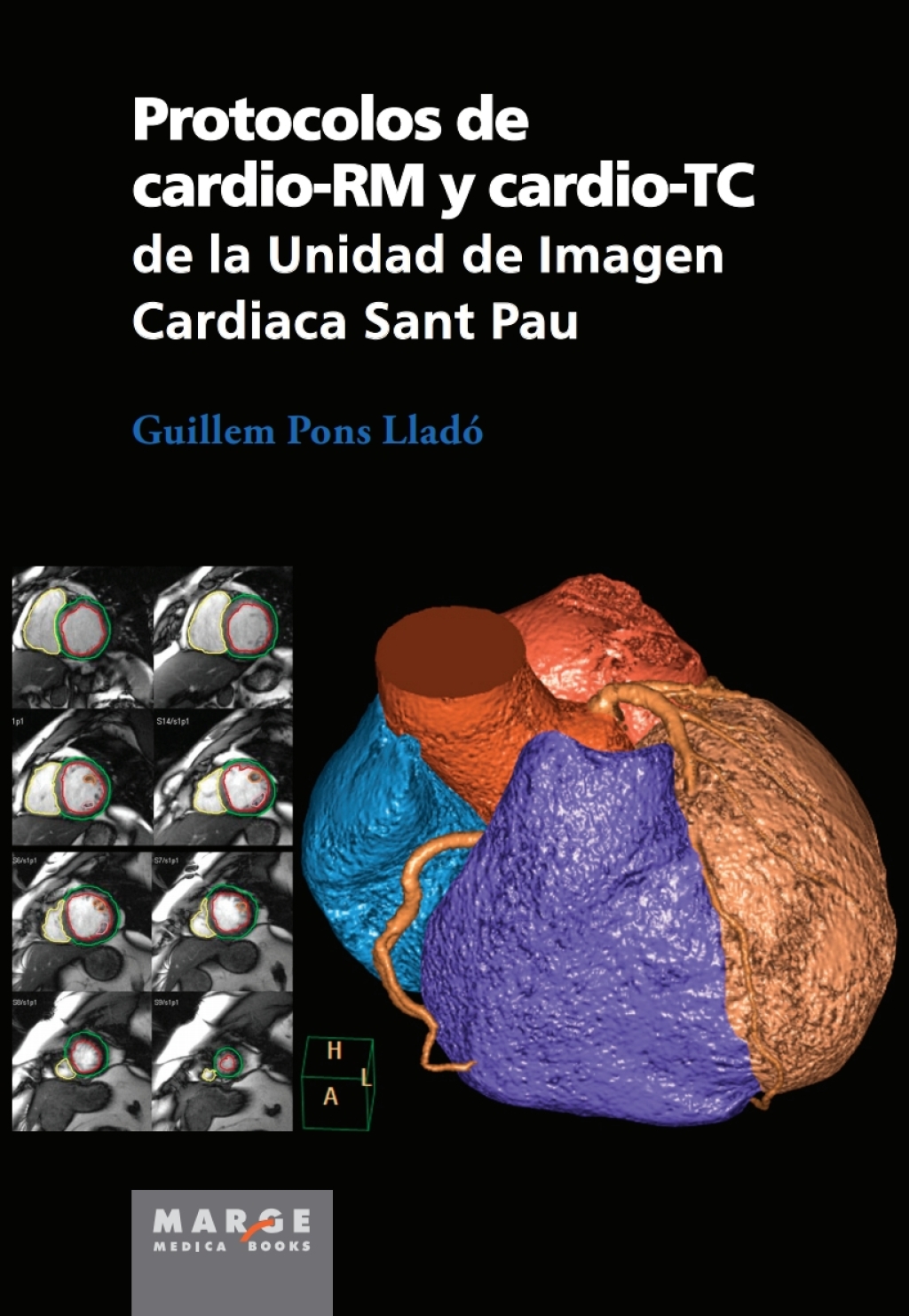 Protocolos de cardio-RM y cardio-TC de la Unidad de Imagen Cardiaca Sant Pau 1st Edition