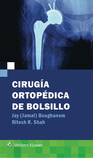 Cover image: Cirugía ortopédica de bolsillo 1st edition 9788416353781