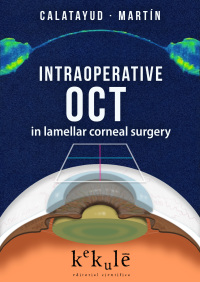 Cover image: Intraoperative OCT in lamellar corneal surgery 1st edition 9788416910045