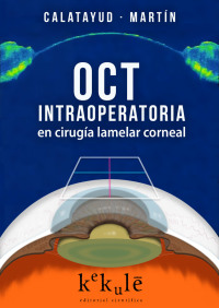 Cover image: OCT intraoperatoria en cirugía lamelar corneal 1st edition 9788416910052