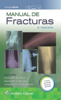 Immagine di copertina: Manual de fracturas 6th edition 9788417949440
