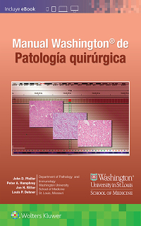 Cover image: Manual Washington de patología quirúrgica 3rd edition 9788418257537