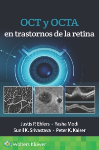 Cover image: OCT y OCTA en trastornos de la retina 9788418563126