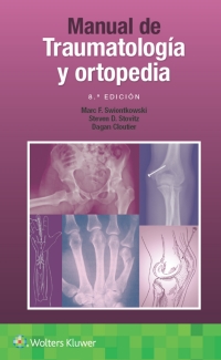 Cover image: Manual de traumatología y ortopedia 8th edition 9788418563355