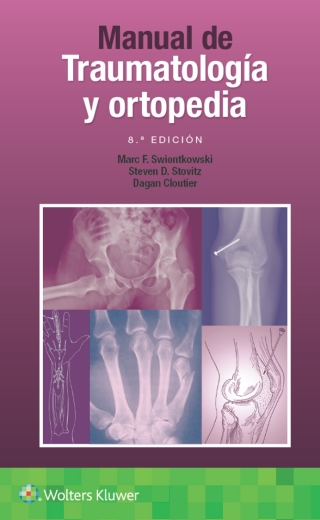 Imagen de portada: Manual de traumatología y ortopedia 8th edition 9788418563355