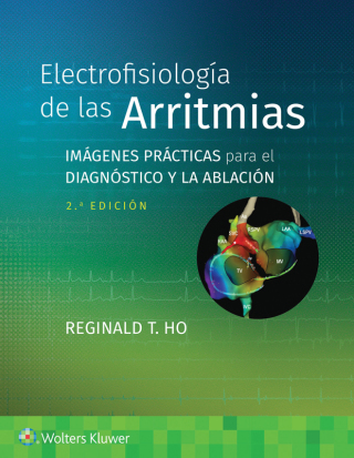 Cover image: Electrofisiología de las arritmias 2nd edition 9788419663061