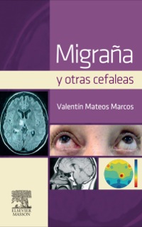 表紙画像: Migraña y otras cefaleas 9788445820636