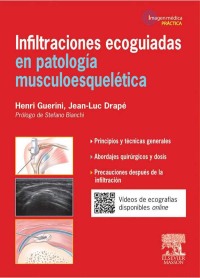صورة الغلاف: Infiltraciones ecoguiadas en patología musculoesquelética 9788445825297