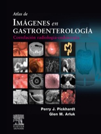 Imagen de portada: Atlas de imágenes en gastroenterología 9788480864510