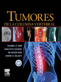 صورة الغلاف: Tumores de la columna vertebral 9788480866408