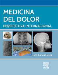 Cover image: Medicina del dolor 9788490226643