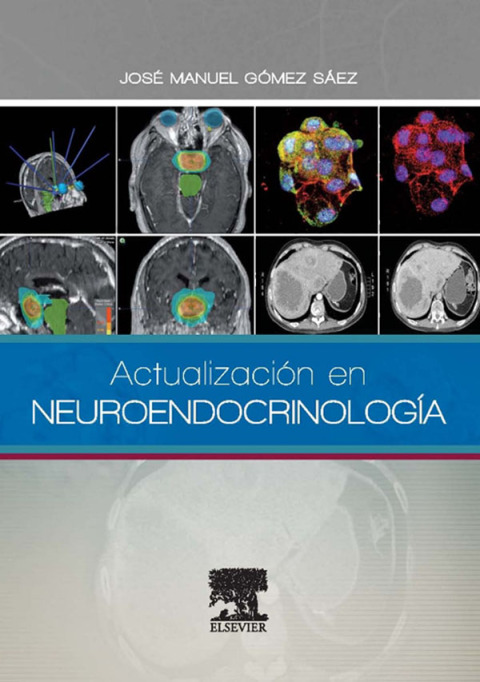 Actualización en Neuroendocrinología - FULL INSTANT DOWNLOAD | PDF DOCX EPUB