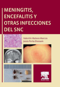表紙画像: Meningitis, encefalitis y otras infecciones del SNC 9788490224847
