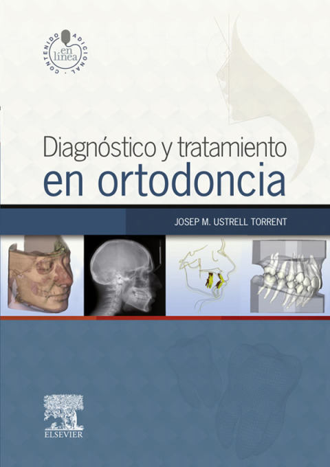 Diagnóstico y tratamiento en ortodoncia - FULL INSTANT DOWNLOAD | PDF DOCX EPUB