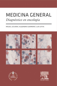 Cover image: Medicina general. Diagnóstico en oncología 9788490227770