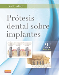 Cover image: Prótesis dental sobre implantes 2nd edition 9788490228630
