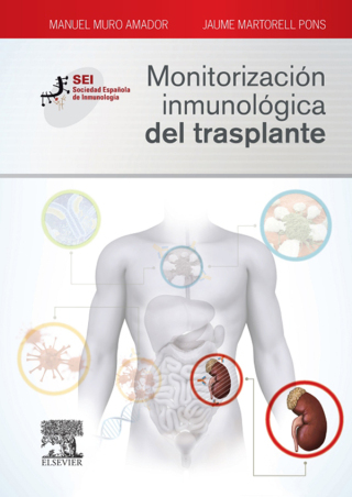 表紙画像: Monitorización inmunológica del trasplante 9788490228883