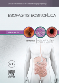 صورة الغلاف: Esofagitis eosinofílica 9788490229545