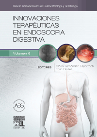 Titelbild: Innovaciones terapéuticas en endoscopia digestiva 9788490229538