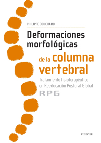 Cover image: Deformaciones morfológicas de la columna vertebral 9788491130635