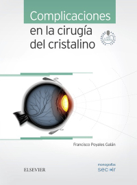 Cover image: Complicaciones en la cirugía del cristalino 9788491130345
