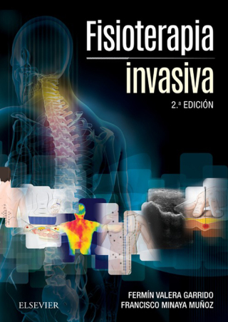 Cover image: Fisioterapia invasiva 2nd edition 9788491130994
