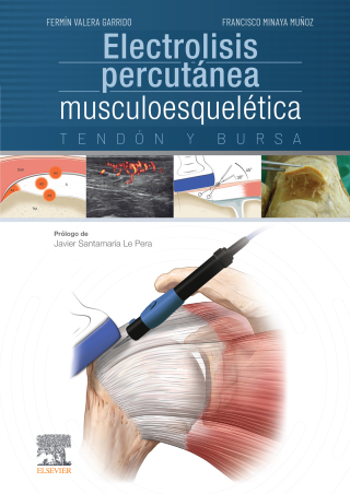 Imagen de portada: Electrolisis percutánea musculoesquelética 1st edition 9788491130161