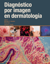Omslagafbeelding: Diagnóstico por imagen en dermatología 9788491131762