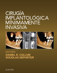 Omslagafbeelding: Cirugía implantológica mínimamente invasiva 9788491131526