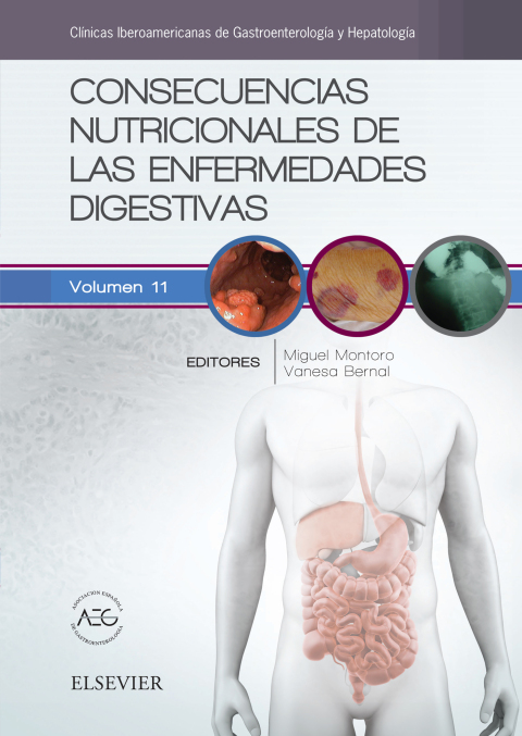 Consecuencias nutricionales de las enfermedades digestivas: Clínicas Iberoamericanas de Gastroenterología y Hepatología vol.11 - FULL INSTANT DOWNLOAD | PDF DOCX EPUB