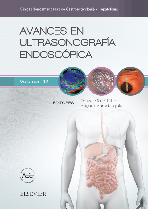Avances en ultrasonografía endoscópica - FULL INSTANT DOWNLOAD | PDF DOCX EPUB