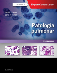 Cover image: Patología pulmonar 2nd edition 9788491132622