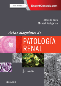 Omslagafbeelding: Atlas diagnóstico de patología renal 3rd edition 9788491132936