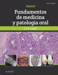Imagen de portada: Cawson.Fundamentos de medicina y patología oral 9th edition 9788491133155