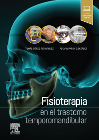 Cover image: Fisioterapia en el trastorno temporomandibular 9788491132837