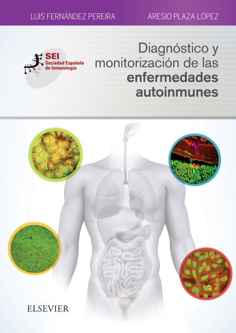 Diagnóstico y monitorización de las enfermedades autoinmunes: Sociedad Española de Inmunología - FULL INSTANT DOWNLOAD | PDF DOCX EPUB