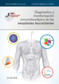 Omslagafbeelding: Diagnóstico y monitorización inmunofenotípica de las neoplasias leucocitarias 9788491132493