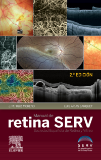 Cover image: Manual de retina SERV 2nd edition 9788491135647