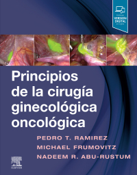 表紙画像: Principios de la cirugía ginecológica oncológica 9788491135173