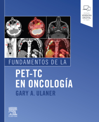 Cover image: Fundamentos de la PET-TC en oncología 9788491136736