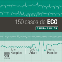 Immagine di copertina: 150 casos de ECG 5th edition 9788491135043