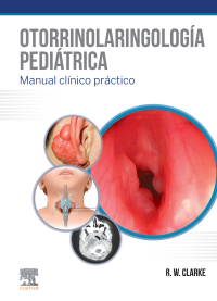 Titelbild: Otorrinolaringología pediátrica 9788491135258
