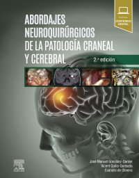 Titelbild: Abordajes neuroquirúrgicos de la patología craneal y cerebral 2nd edition 9788491135029