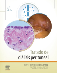 صورة الغلاف: Tratado de diálisis peritoneal 3rd edition 9788491134718