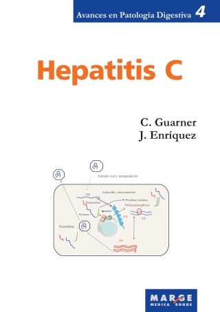 Cover image: Hepatitis C 1st edition 9788492442096
