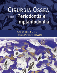 Titelbild: Cirurgia Óssea para Periodontia e Implantodontia 9788535268676
