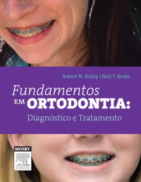 Cover image: Fundamentos em Ortodontia: Diagnóstico e Tratamento 9788535269383